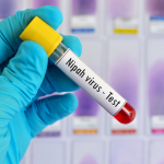 Ramai Virus Nipah, Dokter Minta Masyarakat Tetap Tenang