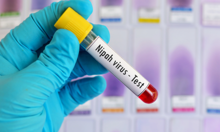 Ramai Virus Nipah, Dokter Minta Masyarakat Tetap Tenang