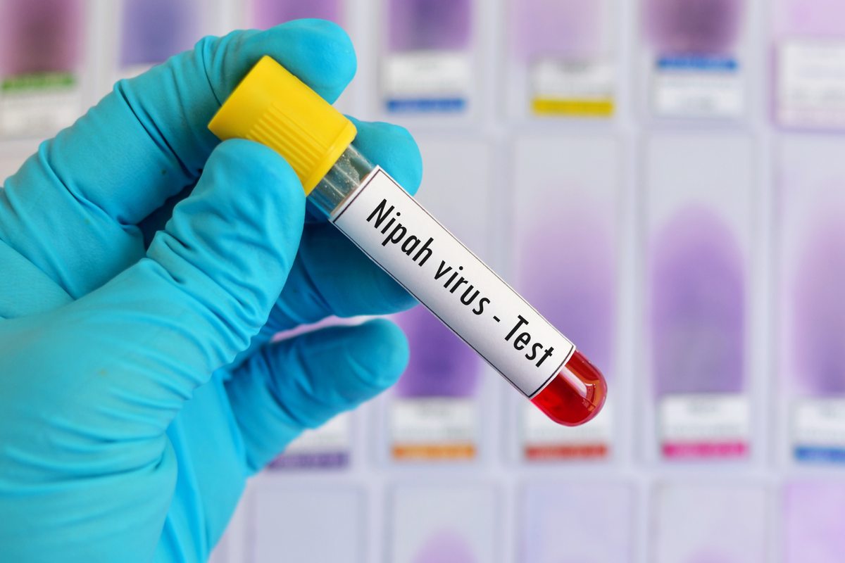 Ramai Virus Nipah, Dokter Minta Masyarakat Tetap Tenang
